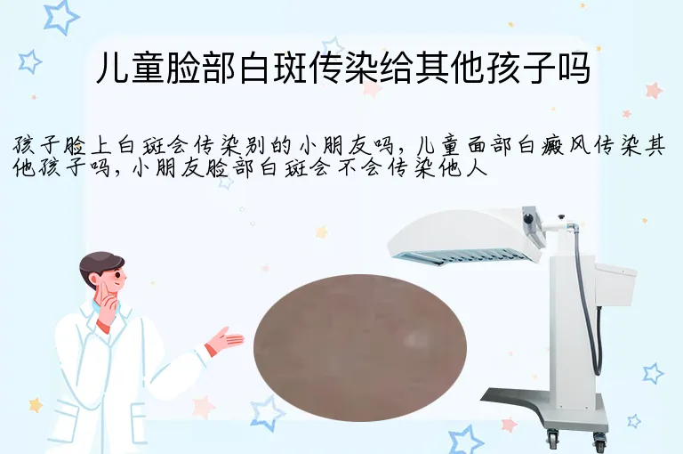 儿童脸部白斑传染给其他孩子吗