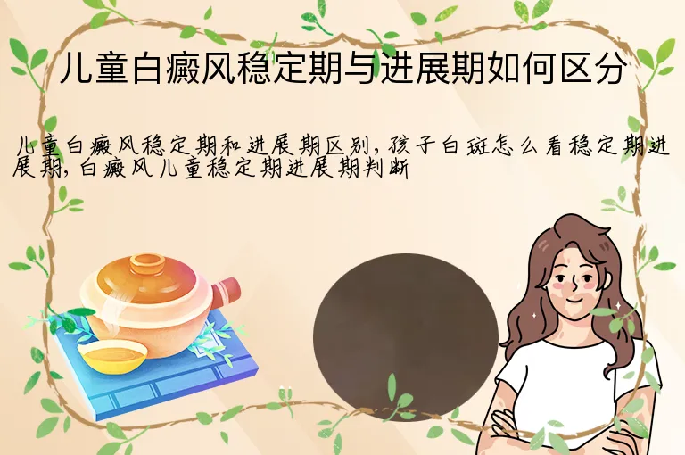 儿童白癜风稳定期与进展期如何区分