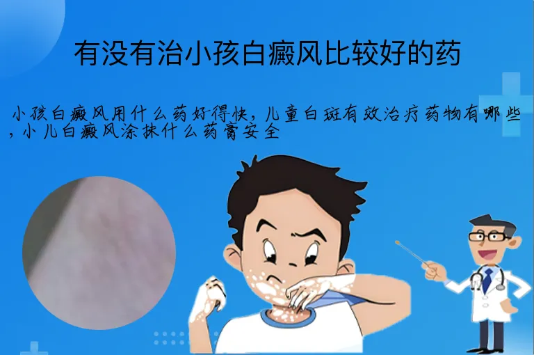 有没有治小孩白癜风比较好的药