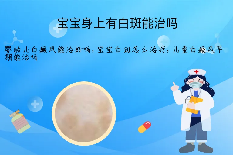 宝宝身上有白斑能治吗