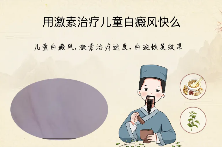 用激素治疗儿童白癜风快么