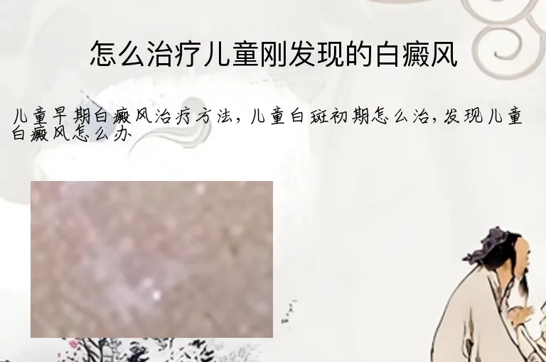 怎么治疗儿童刚发现的白癜风