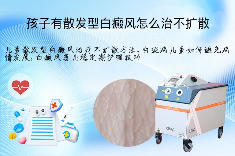 孩子有散发型白癜风怎么治不扩散