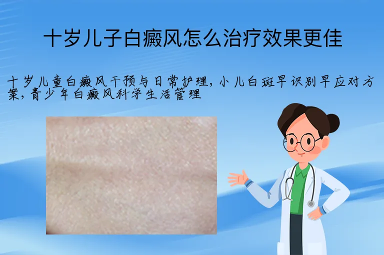 十岁儿子白癜风怎么治疗效果更佳