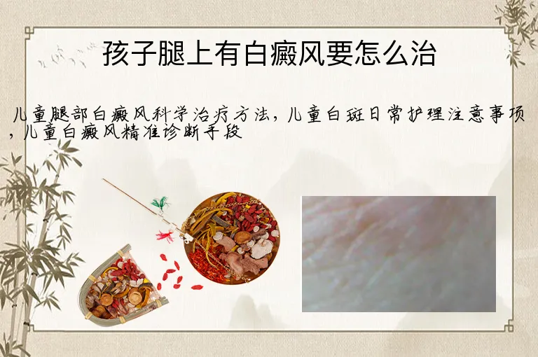 孩子腿上有白癜风要怎么治