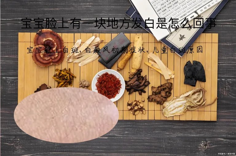 宝宝脸上有一块地方发白是怎么回事