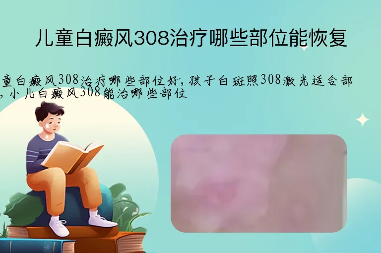 儿童白癜风308治疗哪些部位能恢复