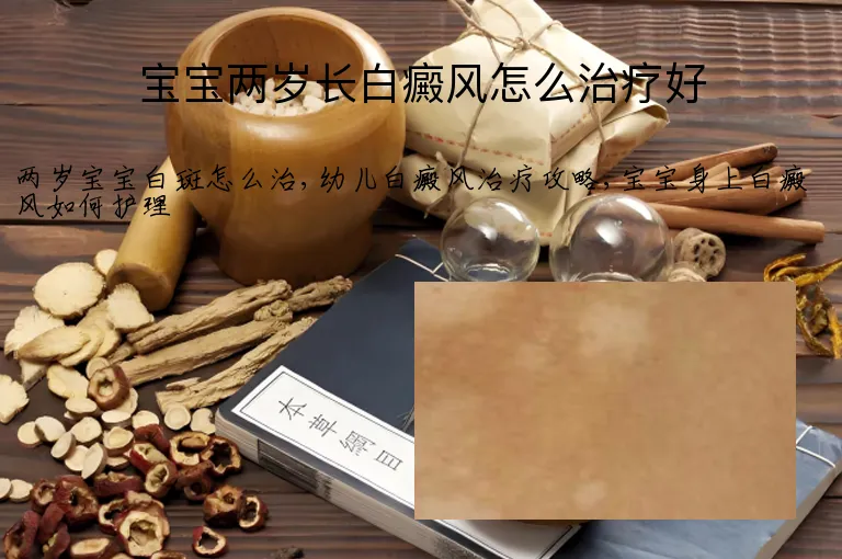 宝宝两岁长白癜风怎么治疗好