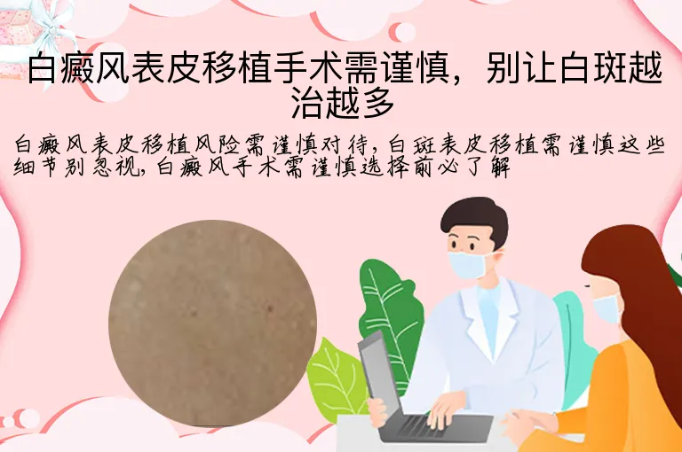 白癜风表皮移植手术需谨慎，别让白斑越治越多
