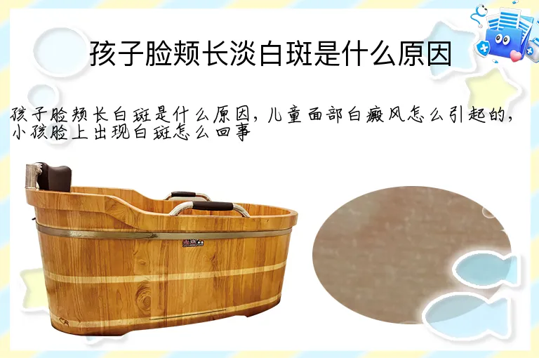 孩子脸颊长淡白斑是什么原因