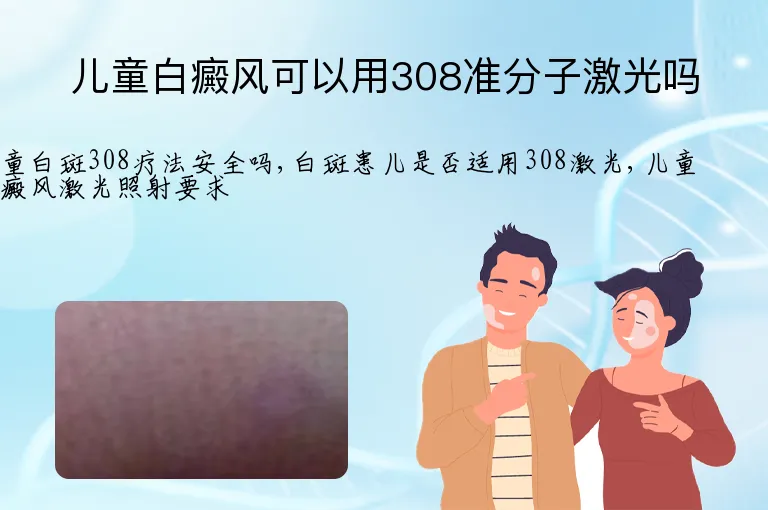 儿童白癜风可以用308准分子激光吗