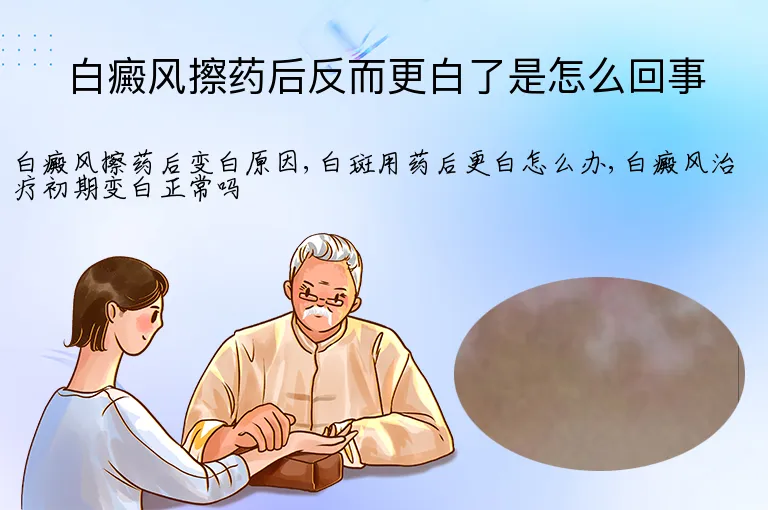 白癜风擦药后反而更白了是怎么回事