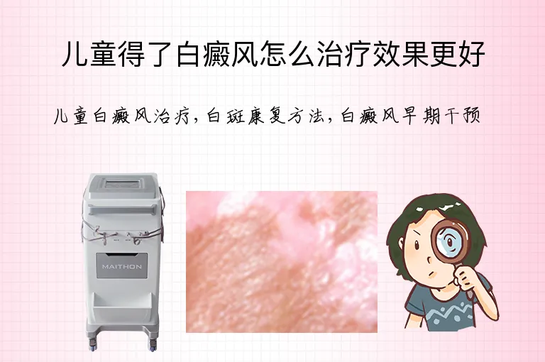 儿童得了白癜风怎么治疗效果更好