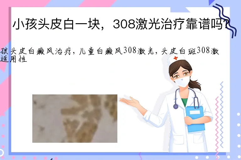 小孩头皮白一块，308激光治疗靠谱吗？