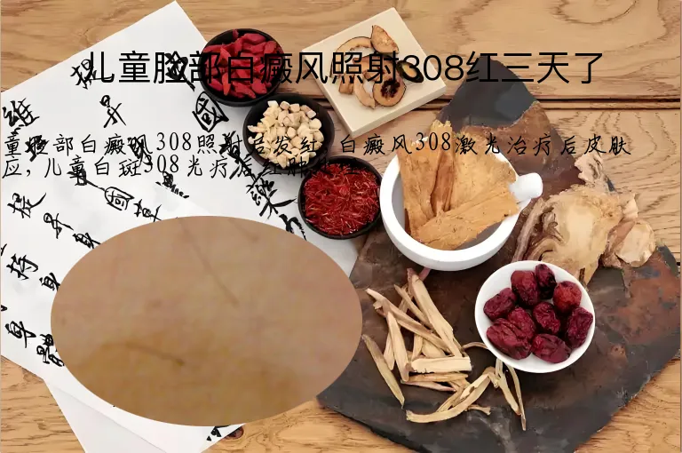 儿童脸部白癜风照射308红三天了