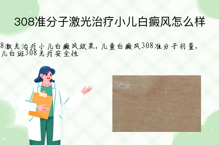 308准分子激光治疗小儿白癜风怎么样