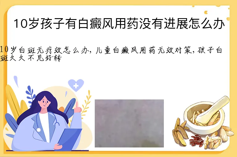 10岁孩子有白癜风用药没有进展怎么办