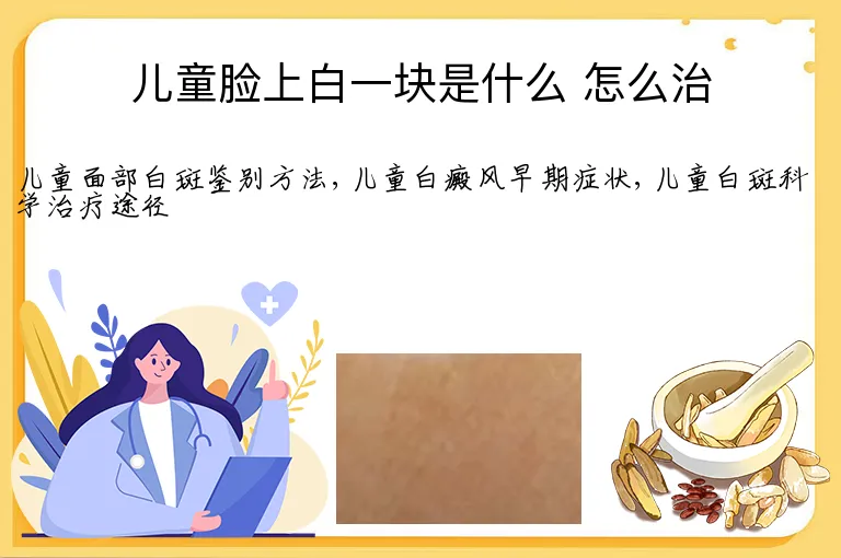 儿童脸上白一块是什么 怎么治