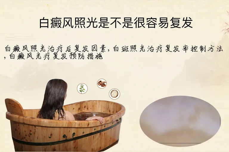 白癜风照光是不是很容易复发