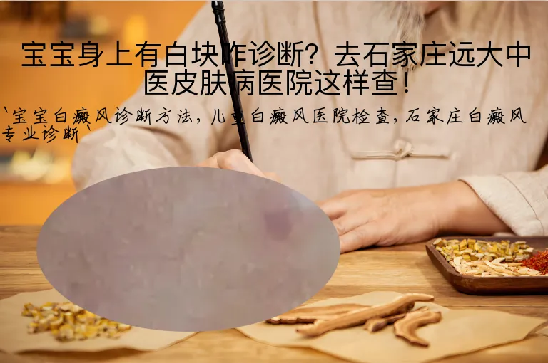 宝宝身上有白块咋诊断？去石家庄远大中医皮肤病医院这样查！