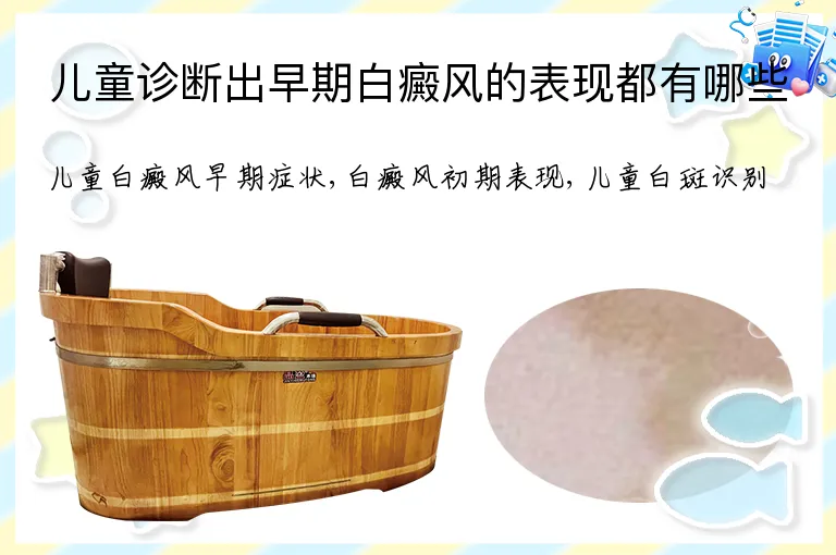 儿童诊断出早期白癜风的表现都有哪些
