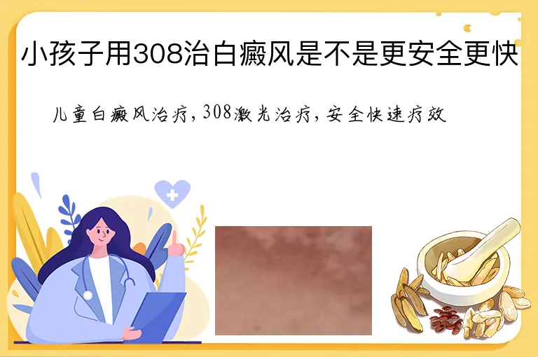 小孩子用308治白癜风是不是更安全更快