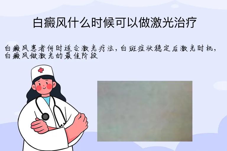 白癜风什么时候可以做激光治疗
