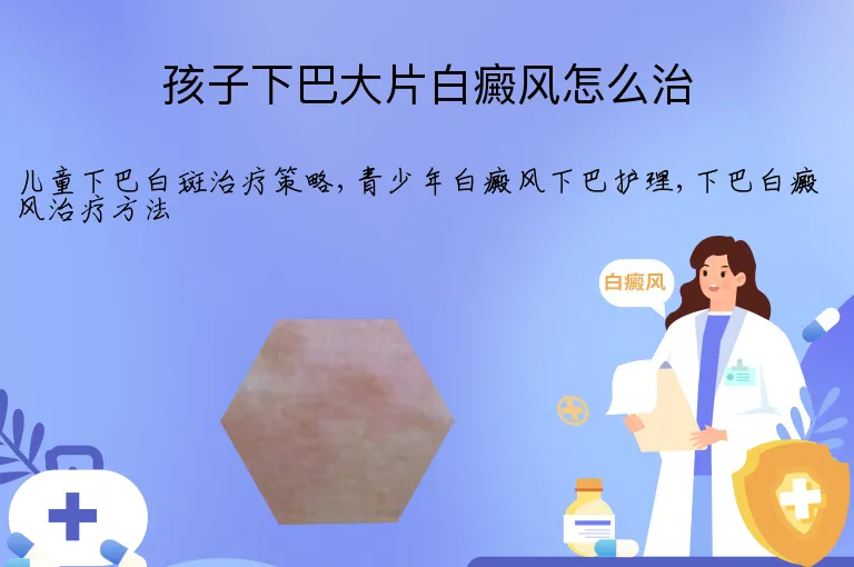 孩子下巴大片白癜风怎么治