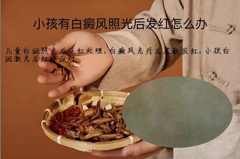 小孩有白癜风照光后发红怎么办