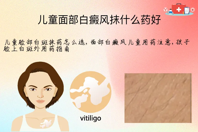 儿童面部白癜风抹什么药好
