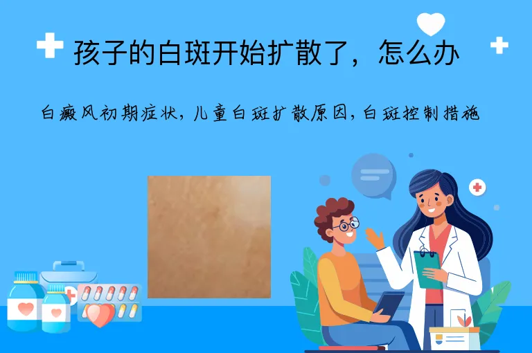 孩子的白斑开始扩散了，怎么办