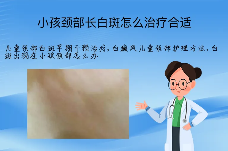 小孩颈部长白斑怎么治疗合适