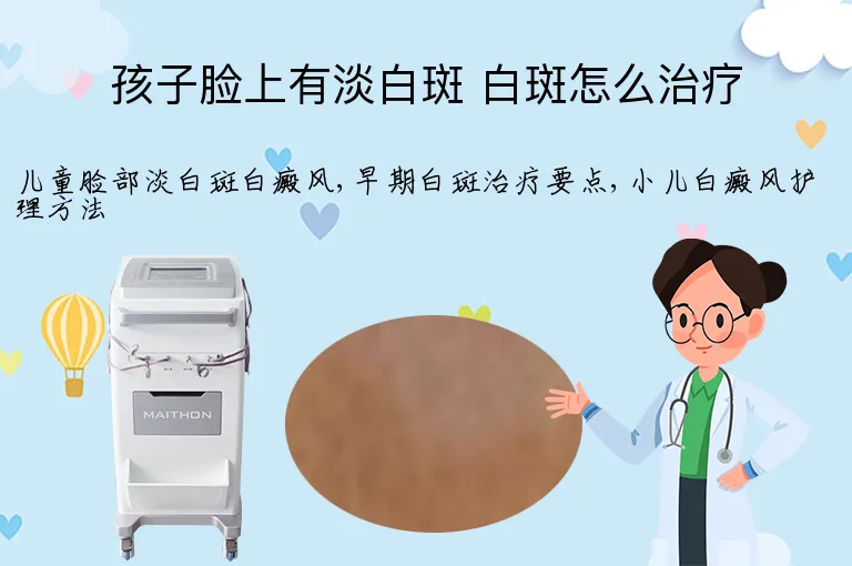 孩子脸上有淡白斑 白斑怎么治疗