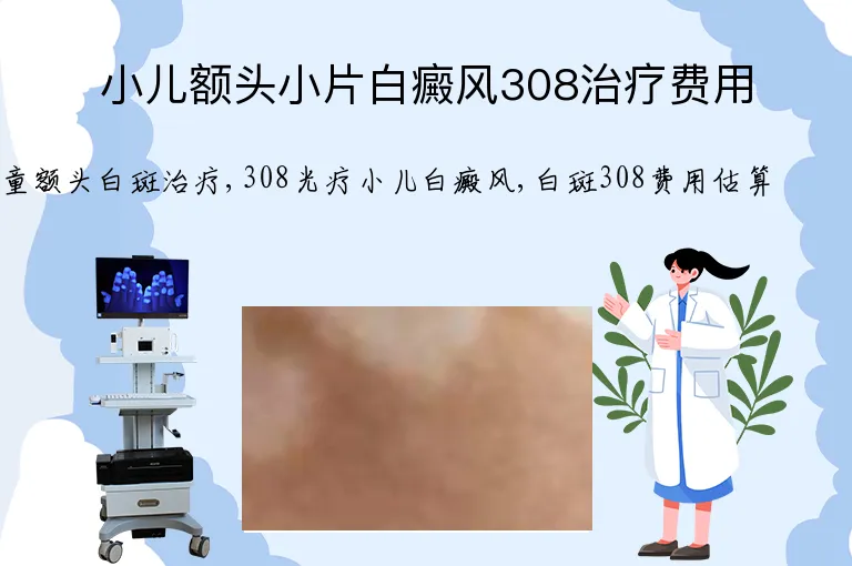 小儿额头小片白癜风308治疗费用