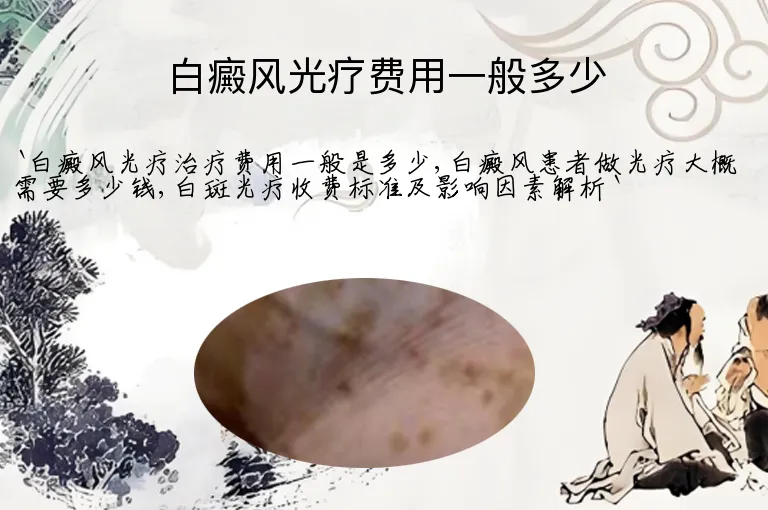 白癜风光疗费用一般多少