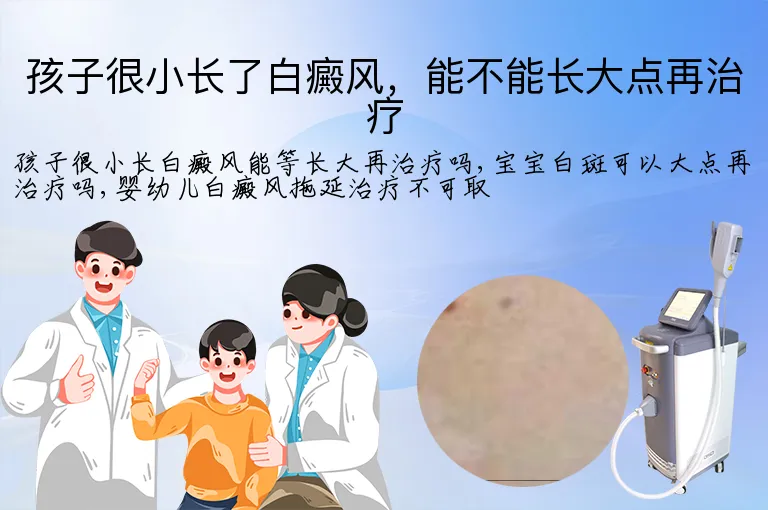 孩子很小长了白癜风，能不能长大点再治疗