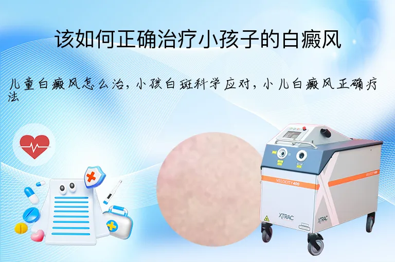 该如何正确治疗小孩子的白癜风
