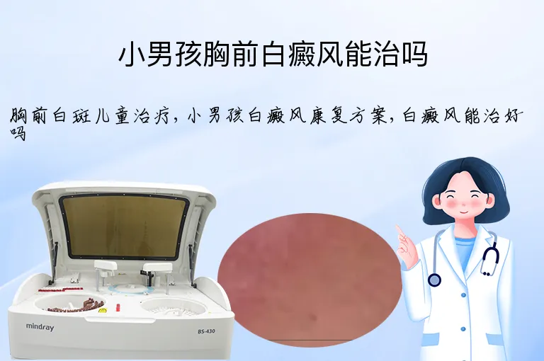 小男孩胸前白癜风能治吗