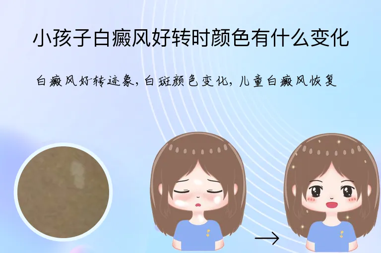 小孩子白癜风好转时颜色有什么变化