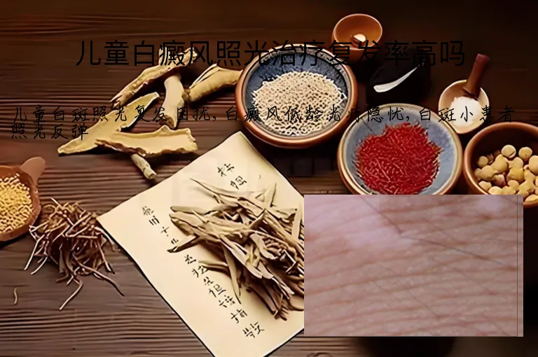 儿童白癜风照光治疗复发率高吗