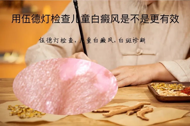 用伍德灯检查儿童白癜风是不是更有效