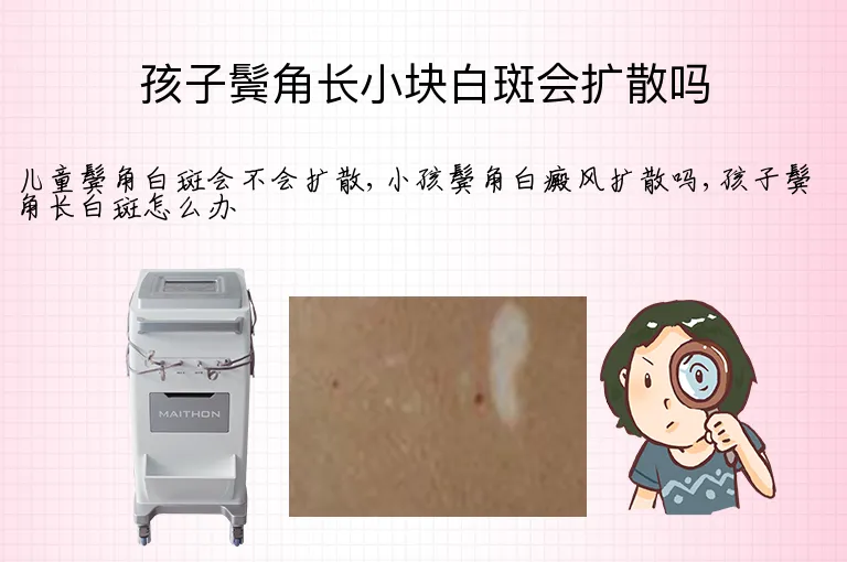 孩子鬓角长小块白斑会扩散吗
