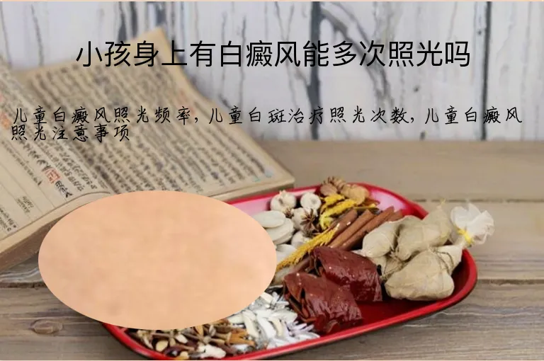 小孩身上有白癜风能多次照光吗
