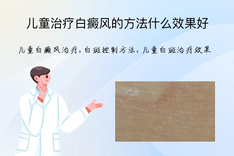 儿童治疗白癜风的方法什么效果好