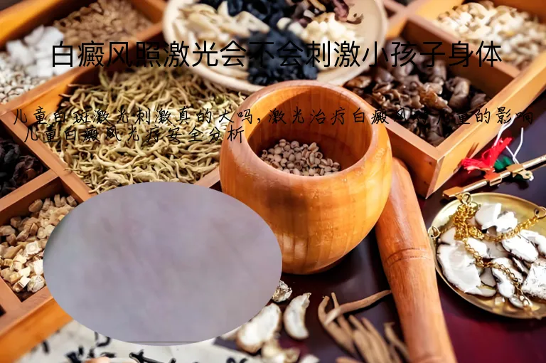 白癜风照激光会不会刺激小孩子身体
