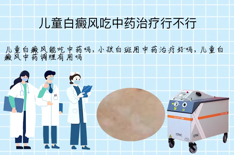 儿童白癜风吃中药治疗行不行