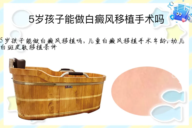 5岁孩子能做白癜风移植手术吗