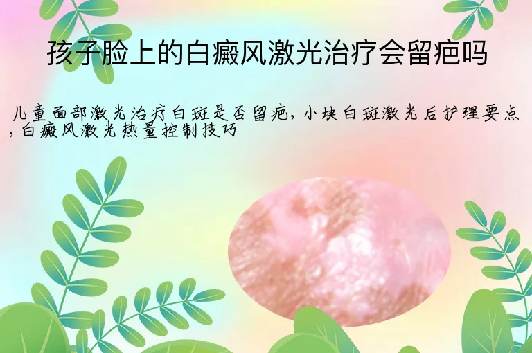 孩子脸上的白癜风激光治疗会留疤吗