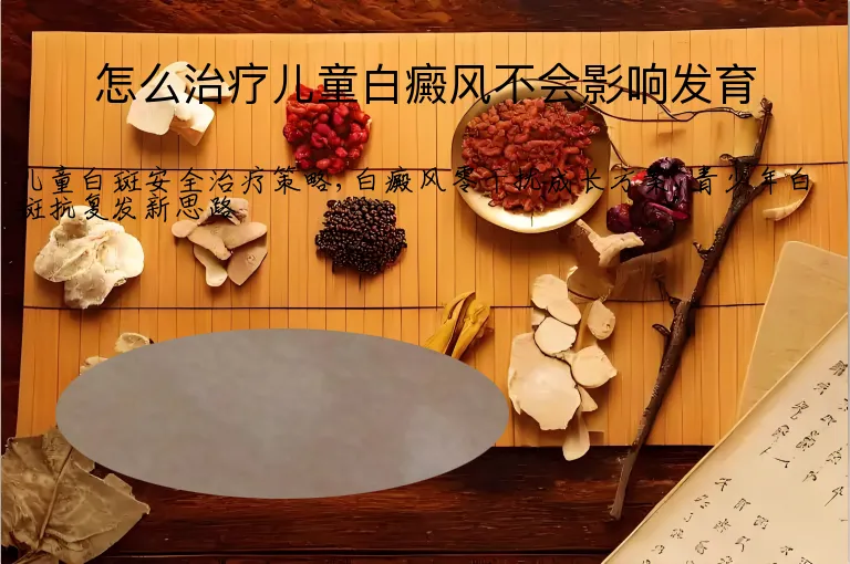 怎么治疗儿童白癜风不会影响发育