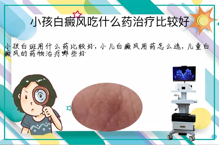 小孩白癜风吃什么药治疗比较好